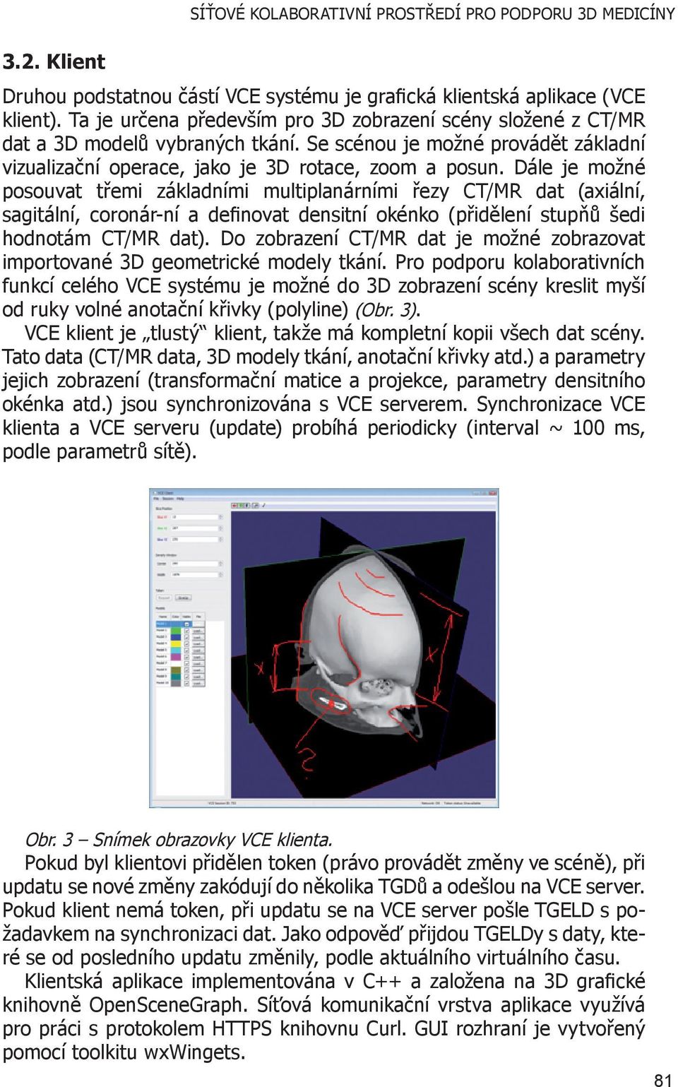 Dále je možné posouvat třemi základními multiplanárními řezy CT/MR dat (axiální, sagitální, coronár-ní a definovat densitní okénko (přidělení stupňů šedi hodnotám CT/MR dat).