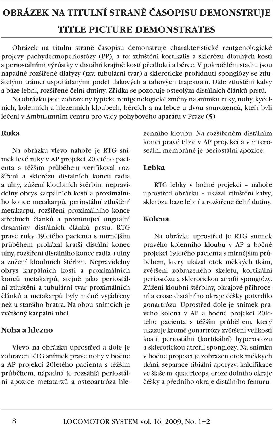 tubulární tvar) a sklerotické prořídnutí spongiózy se ztluštělými trámci uspořádanými podél tlakových a tahových trajektorií. Dále ztluštění kalvy a báze lební, rozšířené čelní dutiny.