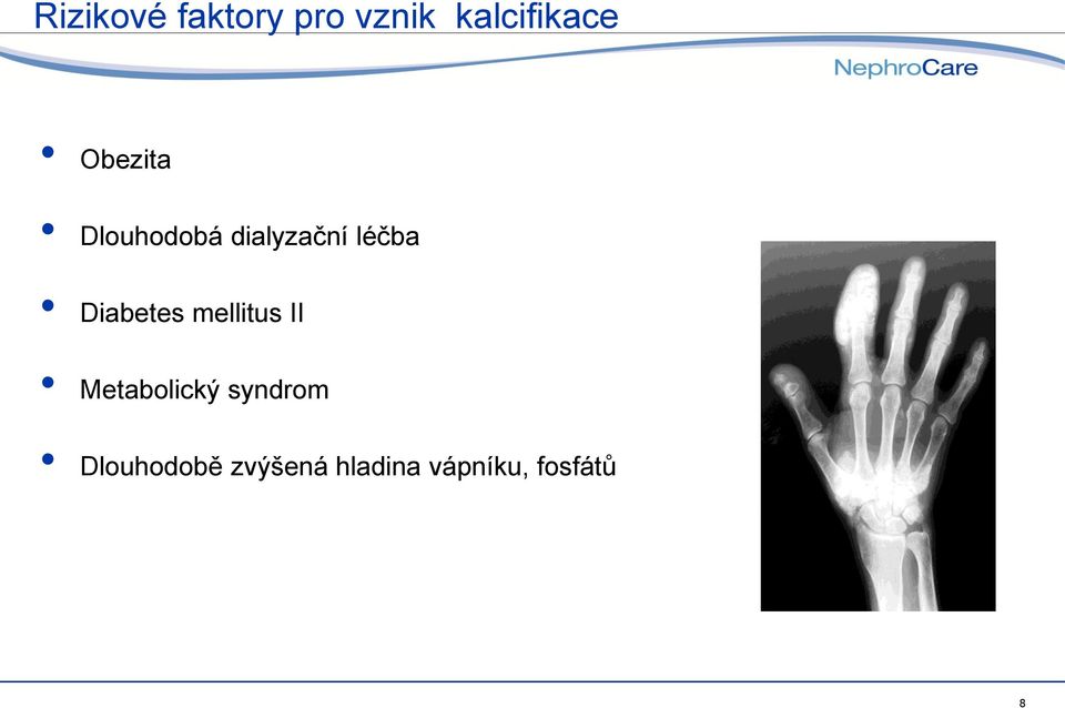 Diabetes mellitus II Metabolický syndrom