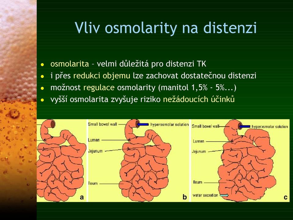 5%...) vyšší osmolarita zvyšuje riziko nežádoucích účinků Waleed A. et al.