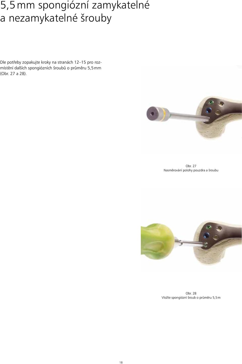 spongiózních šroubů o průměru 5,5 mm (Obr. 27 a 28). Obr.
