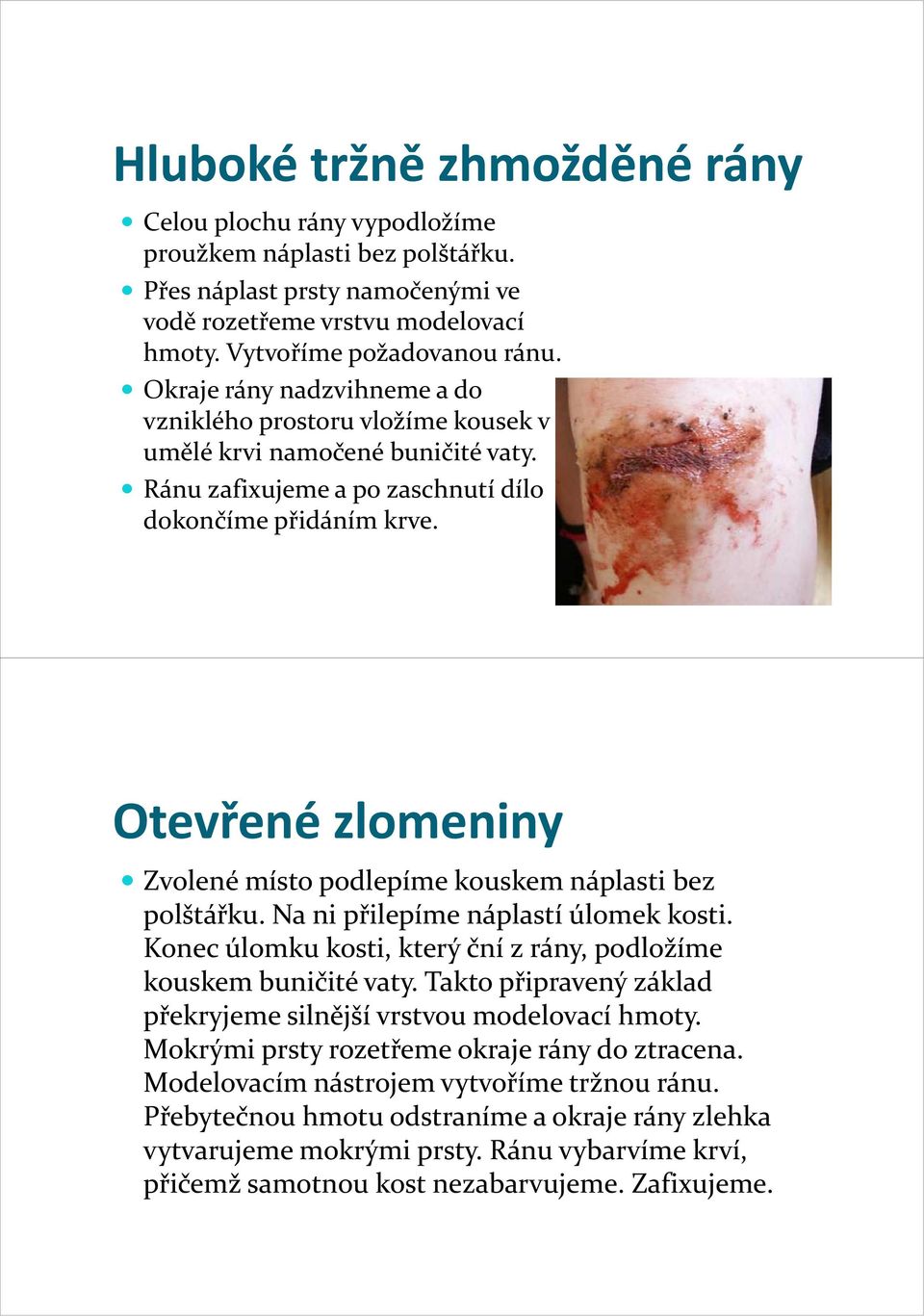 Otevřené zlomeniny Zvolené místo podlepíme kouskem náplasti bez polštářku. Na ni přilepíme náplastí úlomek kosti. Konec úlomku kosti, který ční z rány, podložíme kouskem buničité vaty.