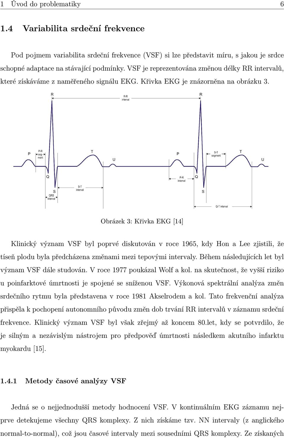 Obrázek 3: Křivka EKG [14] Klinický význam VSF byl poprvé diskutován v roce 1965, kdy Hon a Lee zjistili, že tíseň plodu byla předcházena změnami mezi tepovými intervaly.