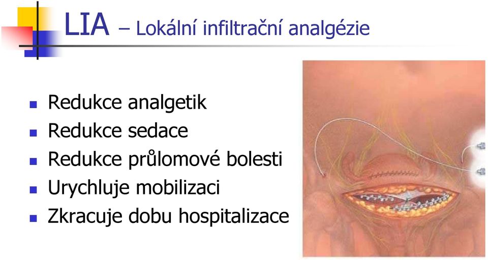 Redukce průlomové bolesti Urychluje