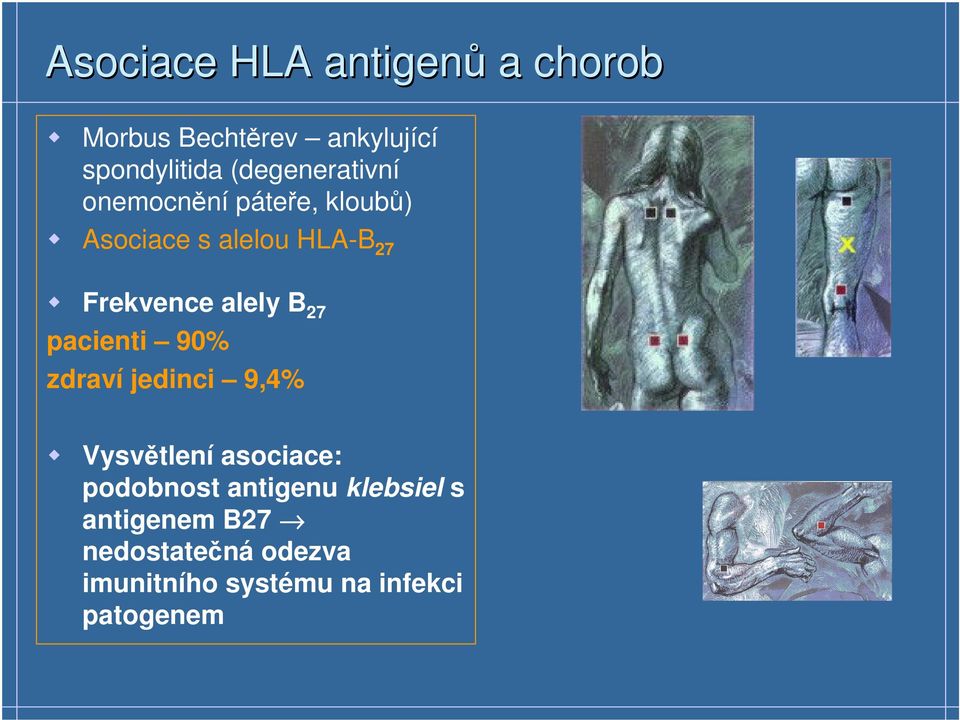 alely B 27 pacienti 90% zdraví jedinci 9,4% Vysvětlení asociace: podobnost