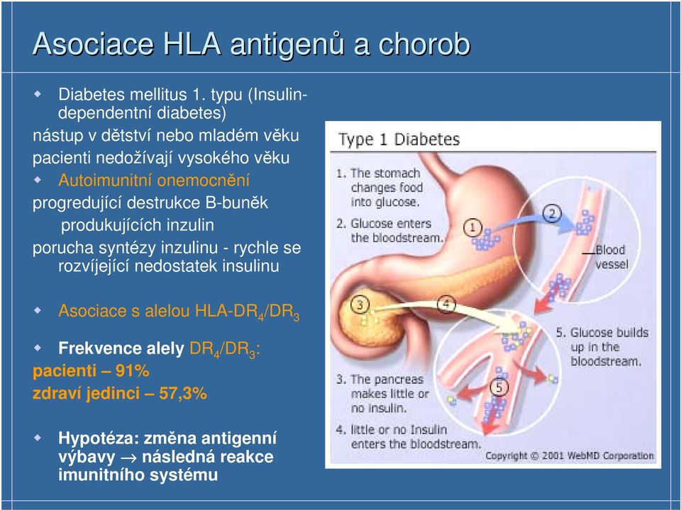 onemocnění progredující destrukce B-buněk produkujících inzulin porucha syntézy inzulinu - rychle se rozvíjející