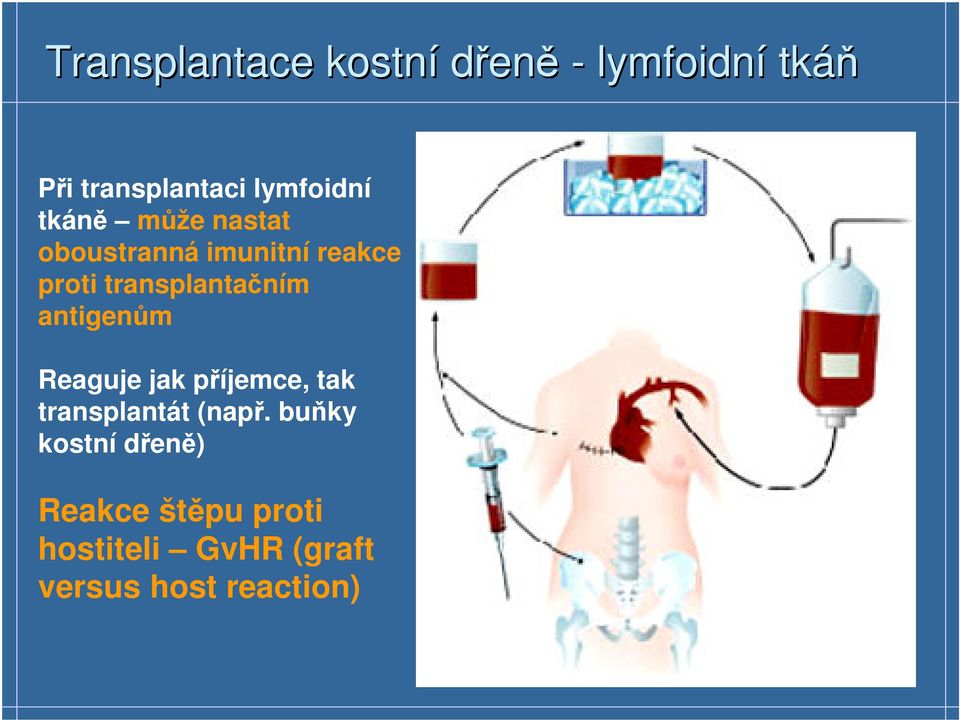 transplantačním antigenům Reaguje jak příjemce, tak transplantát