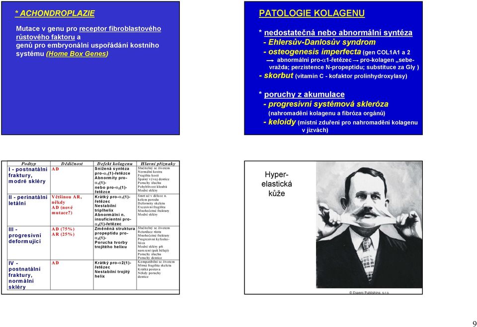 -kofaktor prolinhydroxylasy) * poruchy z akumulace -progresívní systémová skleróza (nahromadění kolagenu a fibróza orgánů) -keloidy (místní zduření pro nahromadění kolagenu v jizvách) Podtyp