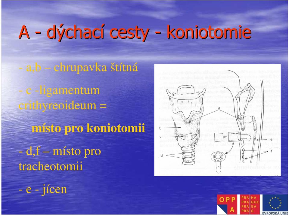 crithyreoideum = místo pro