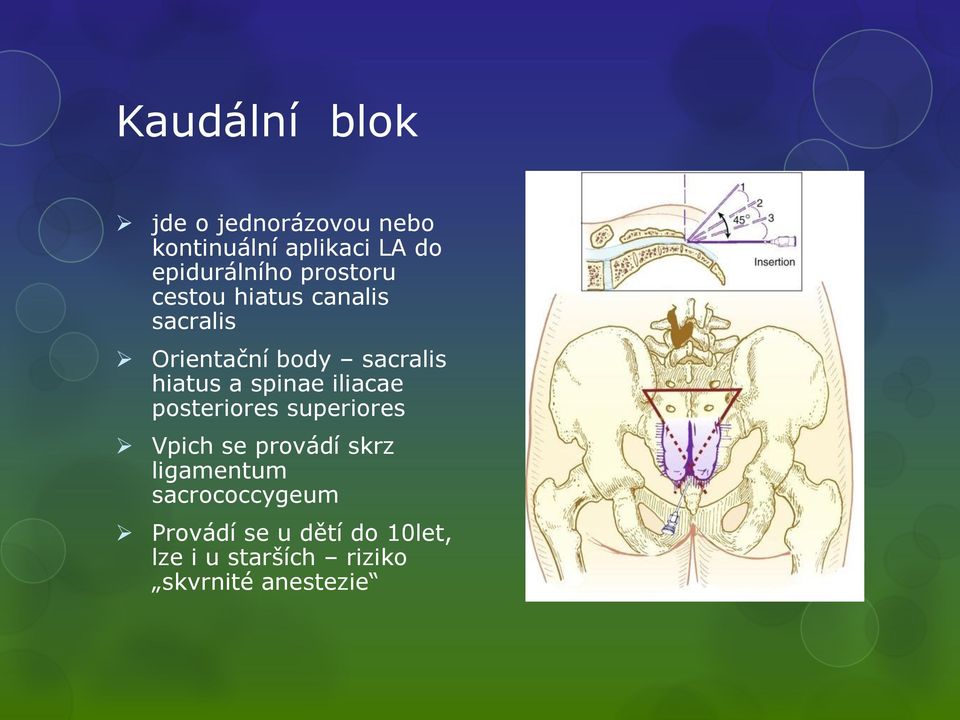 sacralis hiatus a spinae iliacae posteriores superiores Vpich se provádí