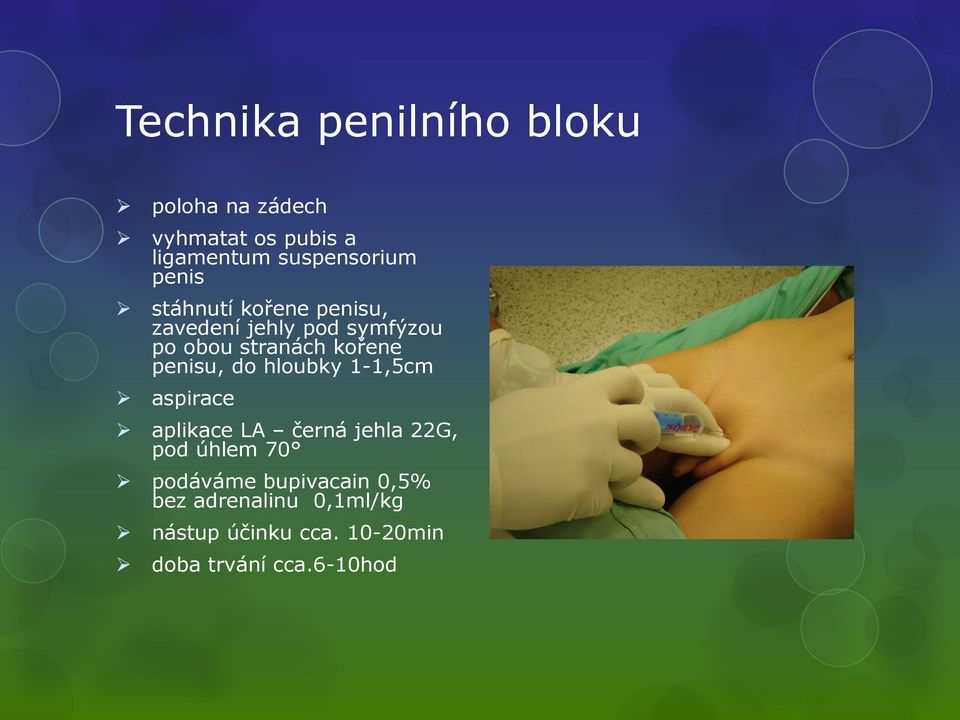 penisu, do hloubky 1-1,5cm aspirace aplikace LA černá jehla 22G, pod úhlem 70 podáváme