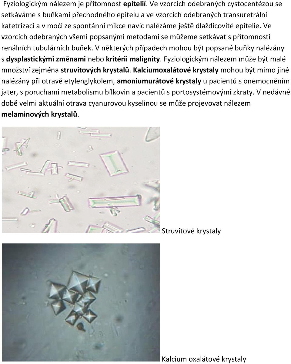 epitelie. Ve vzorcích odebraných všemi popsanými metodami se můžeme setkávat s přítomností renálních tubulárních buňek.