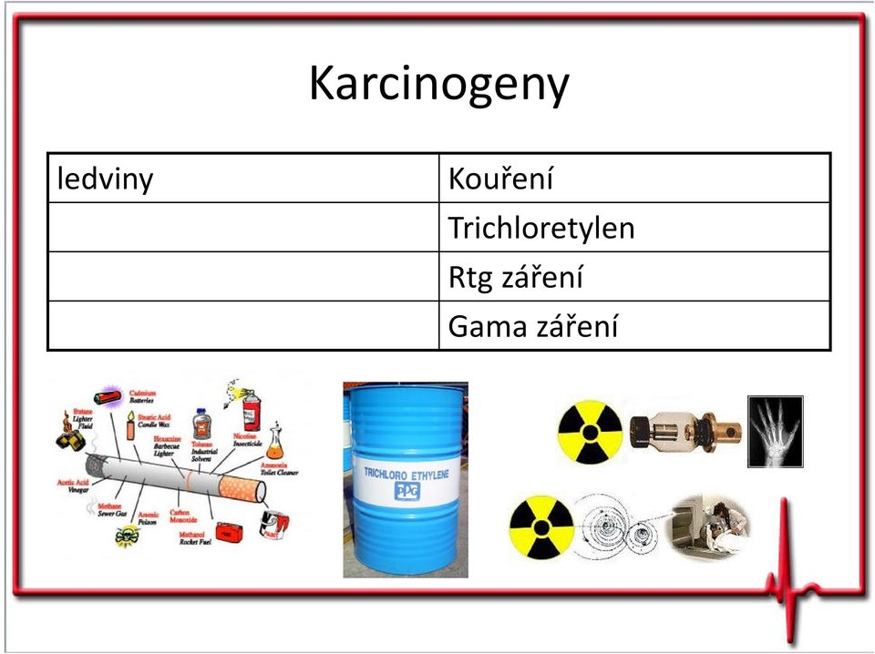 Trichloretylen