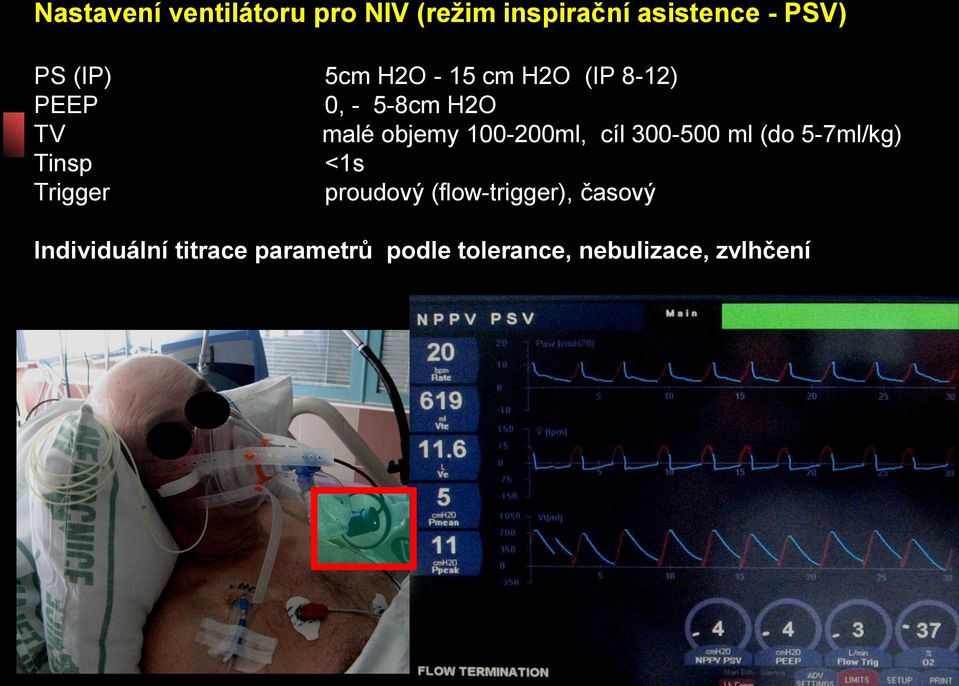 100-200ml, cíl 300-500 ml (do 5-7ml/kg) Tinsp <1s Trigger proudový