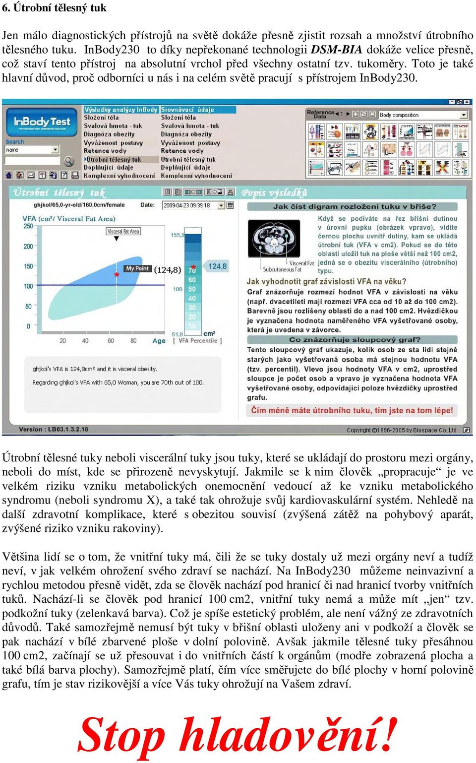 Toto je také hlavní důvod, proč odborníci u nás i na celém světě pracují s přístrojem InBody230.