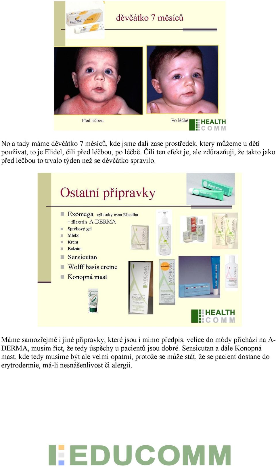 Máme samozřejmě i jiné přípravky, které jsou i mimo předpis, velice do módy přichází na A- DERMA, musím říct, že tedy úspěchy u pacientů