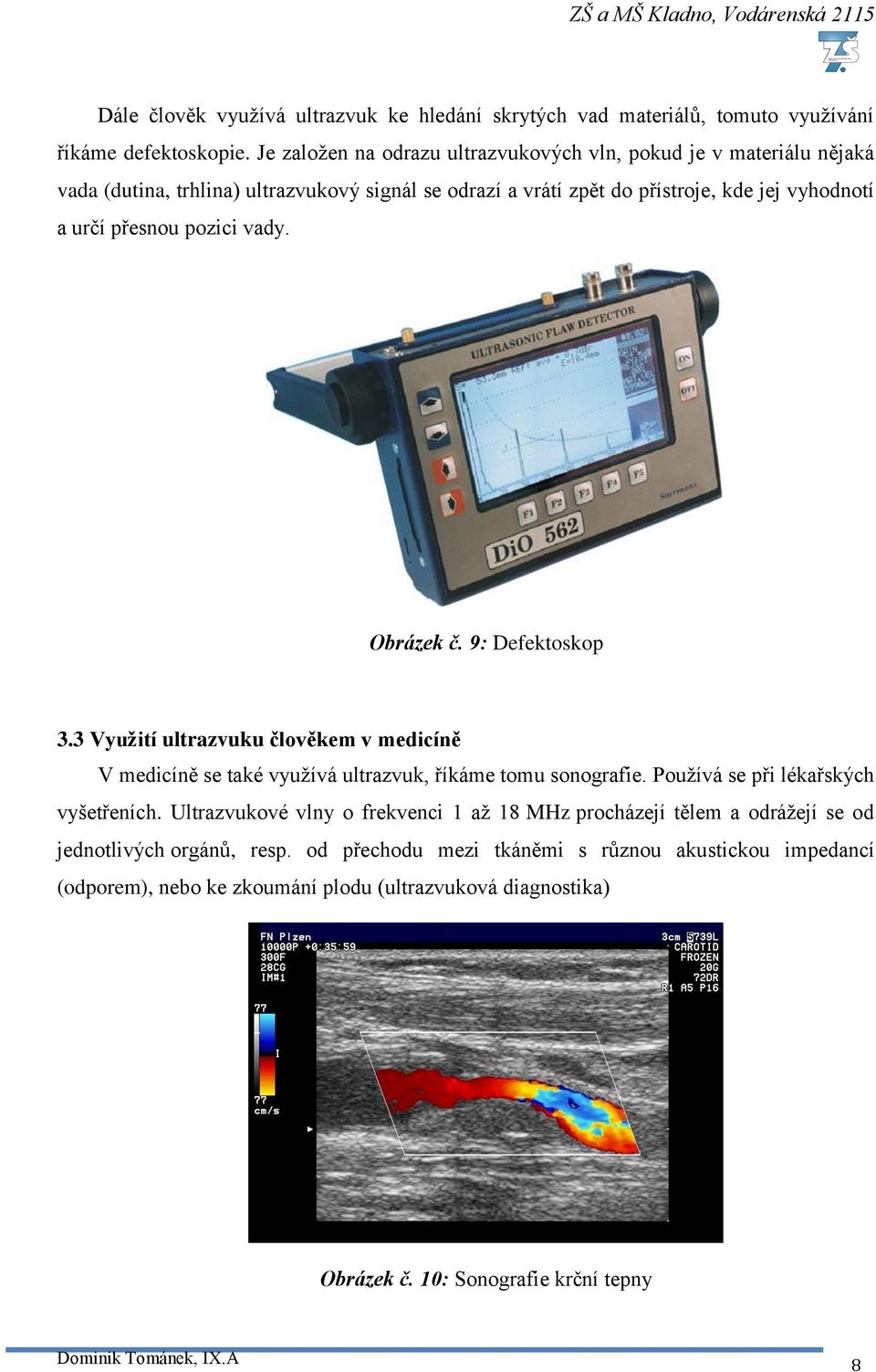 pozici vady. Obrázek č. 9: Defektoskop 3.3 Využití ultrazvuku člověkem v medicíně V medicíně se také využívá ultrazvuk, říkáme tomu sonografie. Používá se při lékařských vyšetřeních.