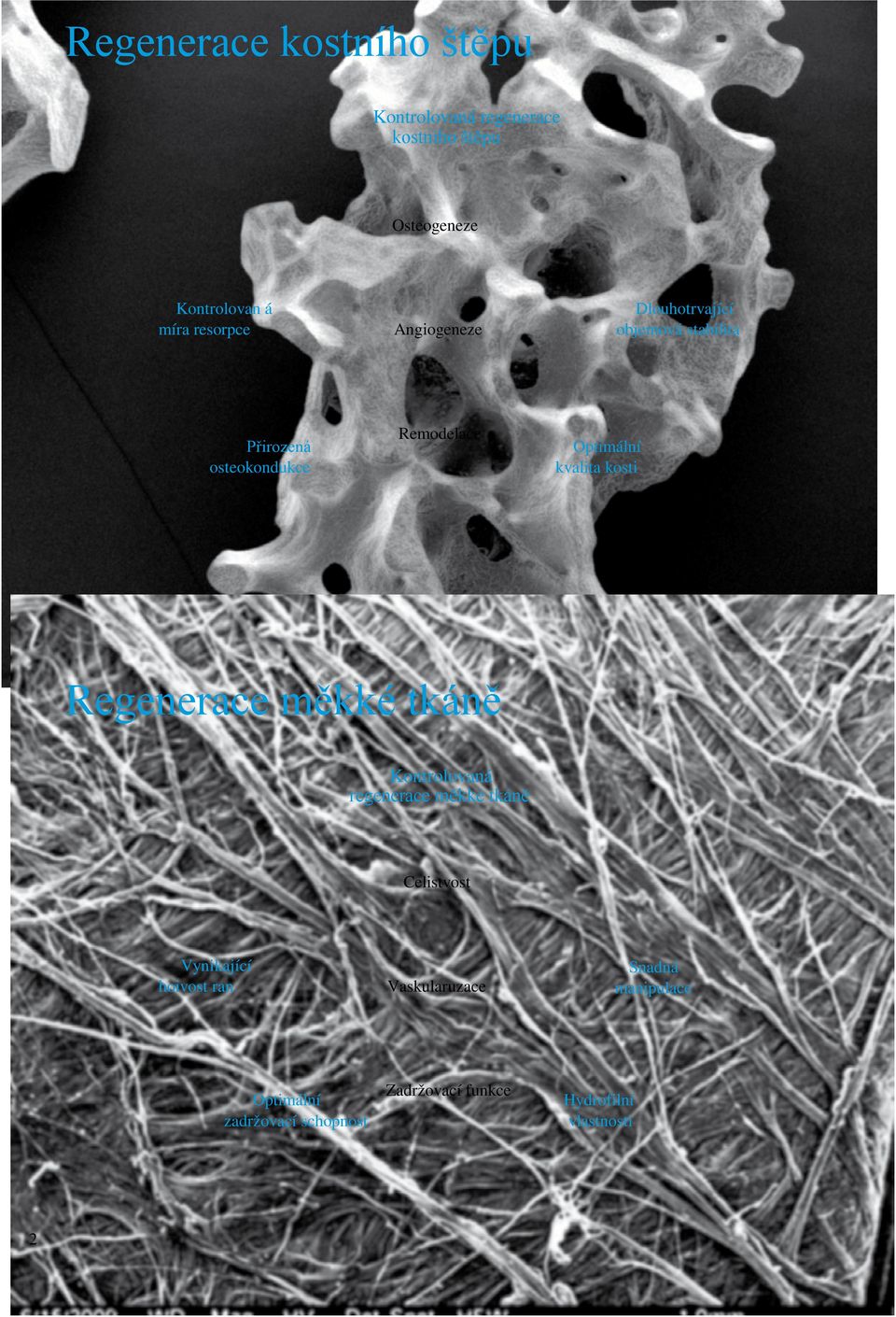 kvalita kosti Regenerace měkké tkáně Kontrolovaná regenerace měkké tkáně Celistvost Vynikající
