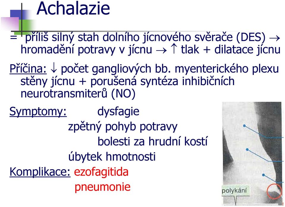 myenterického plexu stěny jícnu + porušená syntéza inhibičních neurotransmiterů (NO)