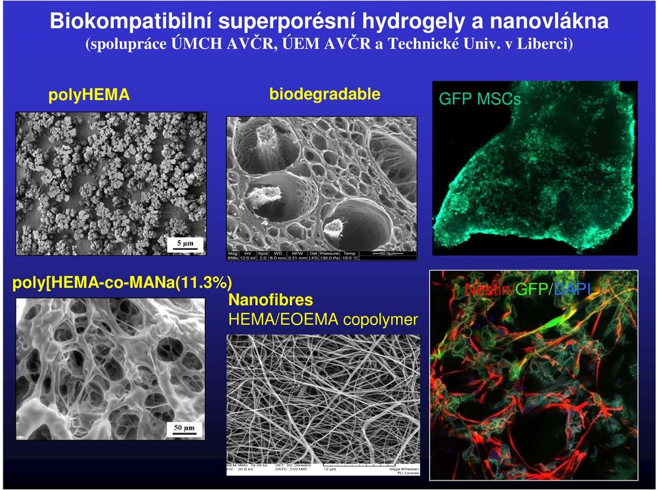 v Liberci) polyhema biodegradable poly[hema-co-mana(11.