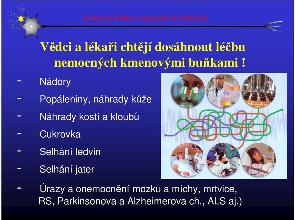 - Nádory - Popáleniny, náhrady kůže - Náhrady kostí a kloubů - Cukrovka -