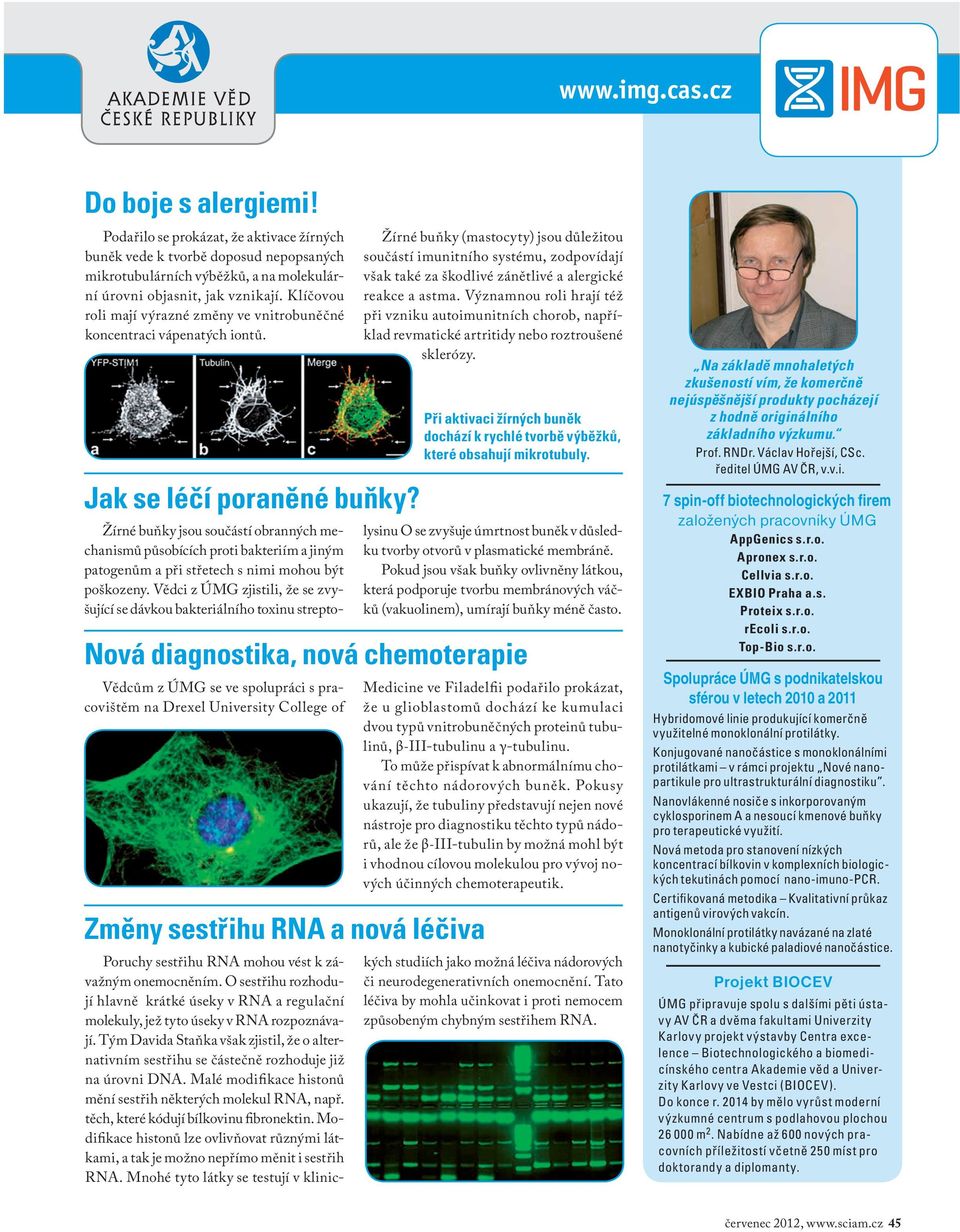 Vědcům z ÚMG se ve spolupráci s pracovištěm na Drexel University College of Žírné buňky (mastocyty) jsou důležitou součástí imunitního systému, zodpovídají však také za škodlivé zánětlivé a alergické