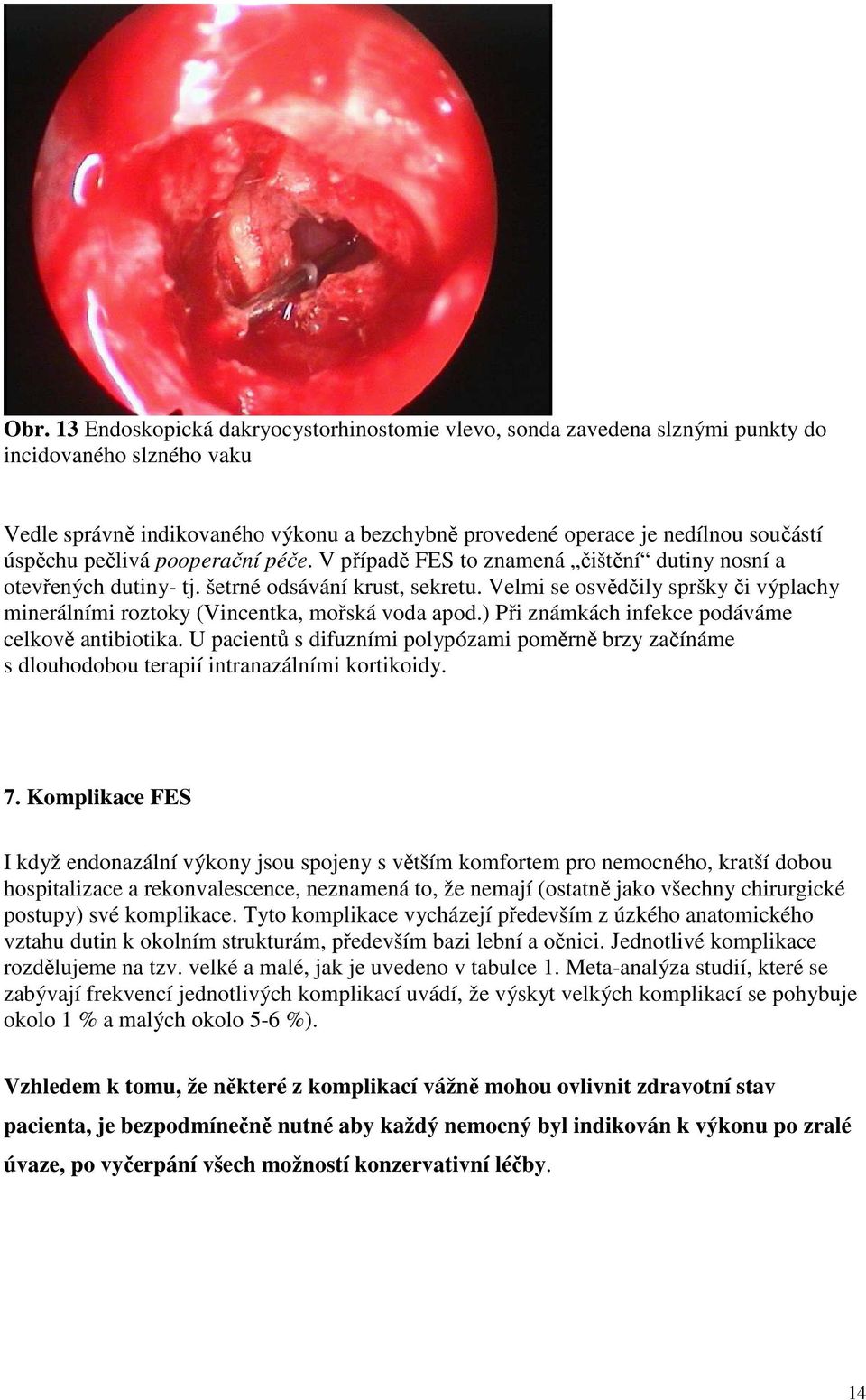 Velmi se osvědčily spršky či výplachy minerálními roztoky (Vincentka, mořská voda apod.) Při známkách infekce podáváme celkově antibiotika.