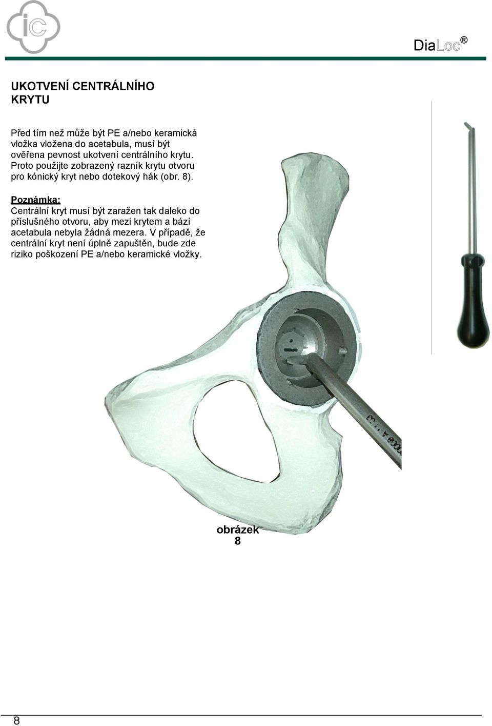 8). Poznámka: Centrální kryt musí být zaražen tak daleko do příslušného otvoru, aby mezi krytem a bází acetabula nebyla