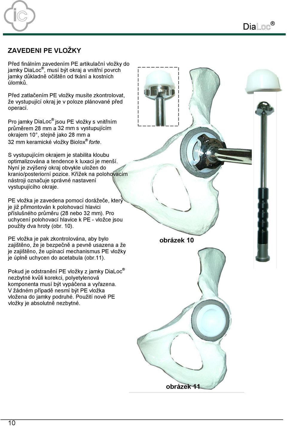 Pro jamky DiaLoc jsou PE vložky s vnitřním průměrem 28 mm a 32 mm s vystupujícím okrajem 10, stejně jako 28 mm a 32 mm keramické vložky Biolox forte.