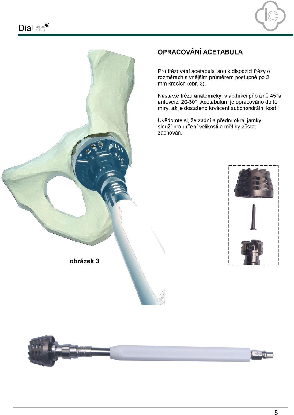 Nastavte frézu anatomicky, v abdukci přibližně 45 a anteverzi 20-30.