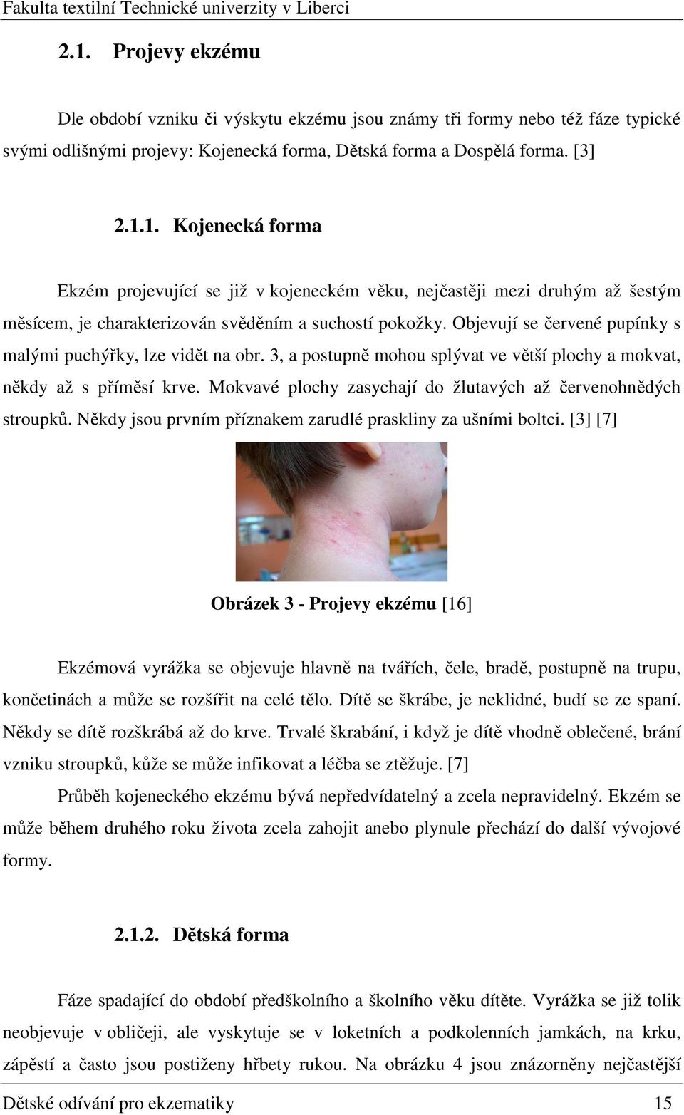 Mokvavé plochy zasychají do žlutavých až červenohnědých stroupků. Někdy jsou prvním příznakem zarudlé praskliny za ušními boltci.