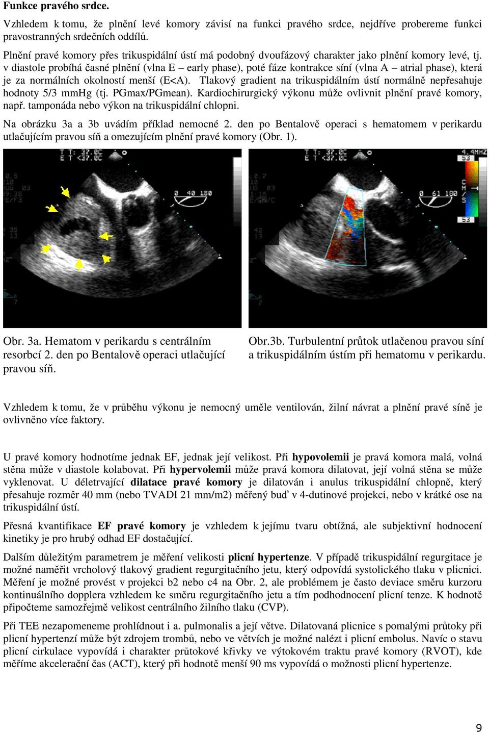 v diastole probíhá časné plnění (vlna E early phase), poté fáze kontrakce síní (vlna A atrial phase), která je za normálních okolností menší (E<A).