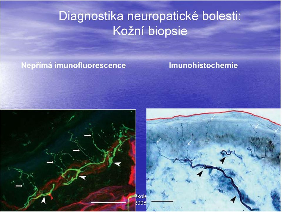 Kožní biopsie Nepřímá