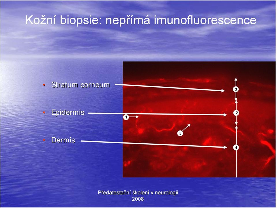 imunofluorescence