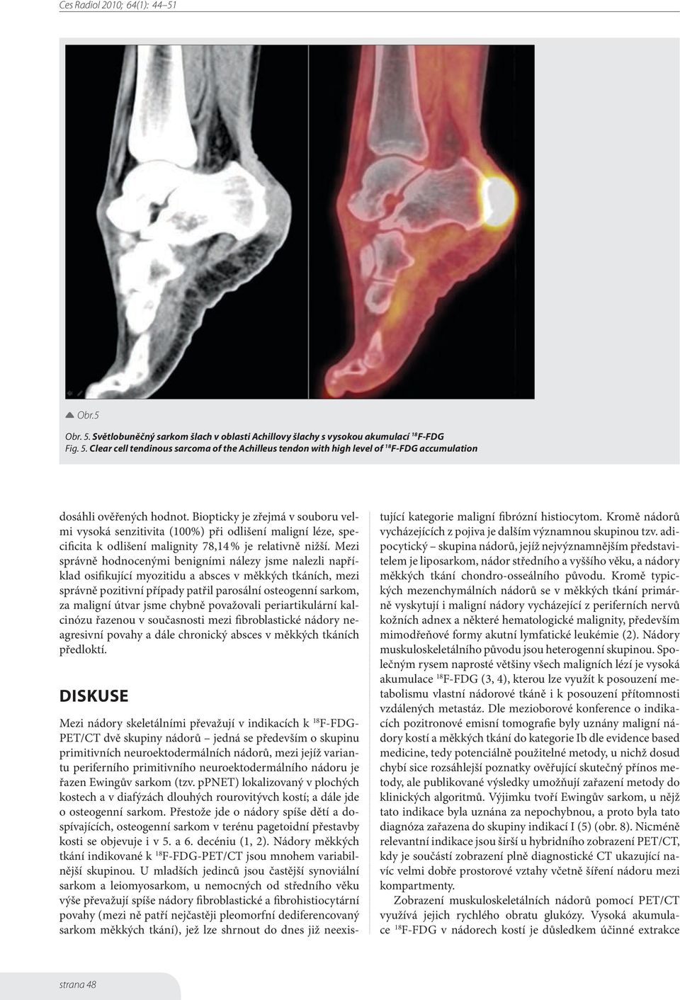 Mezi správně hodnocenými benigními nálezy jsme nalezli například osifikující myozitidu a absces v měkkých tkáních, mezi správně pozitivní případy patřil parosální osteogenní sarkom, za maligní útvar