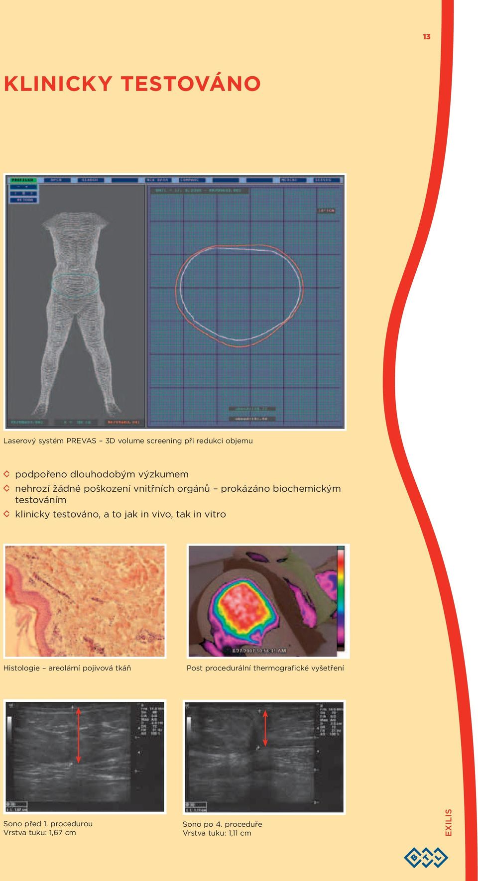 klinicky testováno, a to jak in vivo, tak in vitro Histologie areolární pojivová tkáň Post