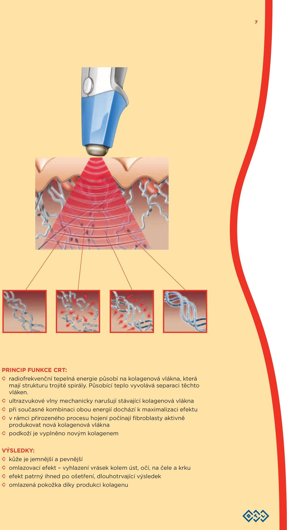 ultrazvukové vlny mechanicky narušují stávající kolagenová vlákna při současné kombinaci obou energií dochází k maximalizaci efektu v rámci přirozeného procesu