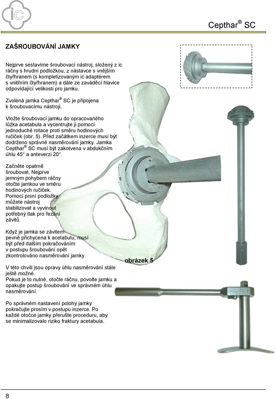 Vloţte šroubovací jamku do opracovaného lůţka acetabula a vycentrujte ji pomocí jednoduché rotace proti směru hodinových ručiček (obr. 5).