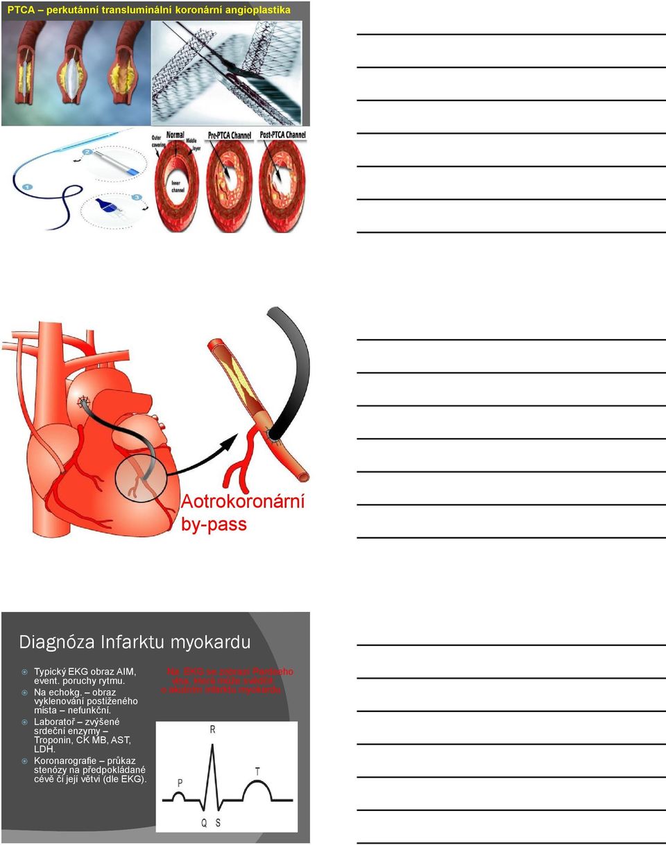 Laboratoř zvýšené srdeční enzymy Troponin, CK MB, AST, LDH.