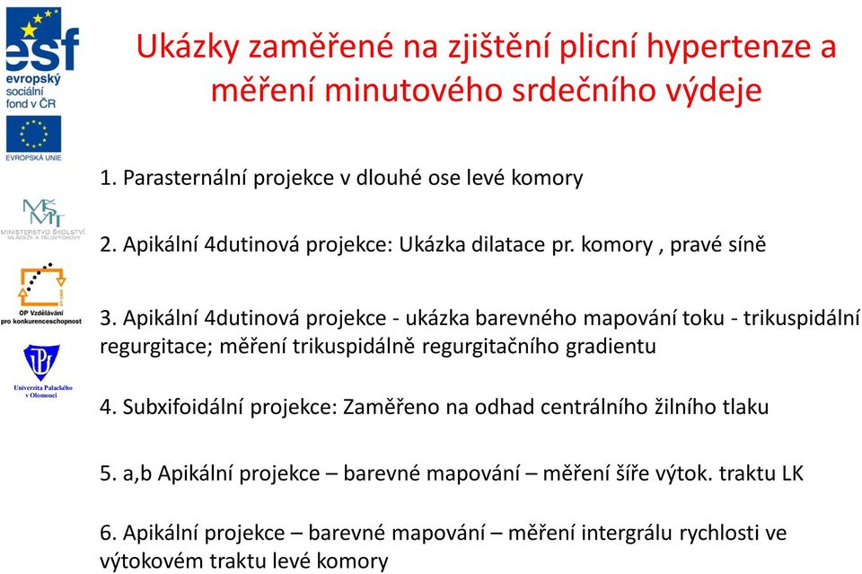 Apikální 4dutinová projekce - ukázka barevného mapování toku - trikuspidální regurgitace; měření trikuspidálně regurgitačního gradientu 4.