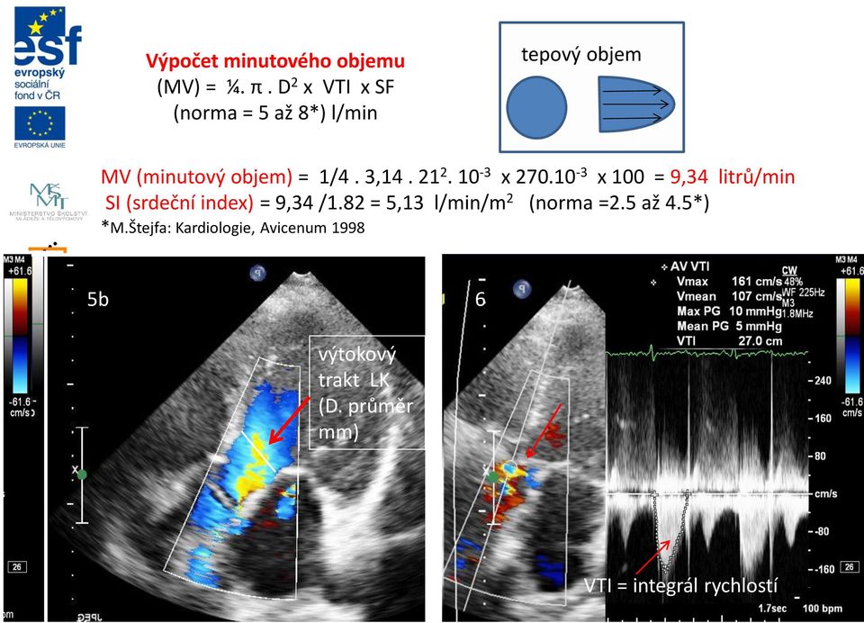 21 2. 10-3 x 270.10-3 x 100 = 9,34 litrů/min SI (srdeční index) = 9,34 /1.