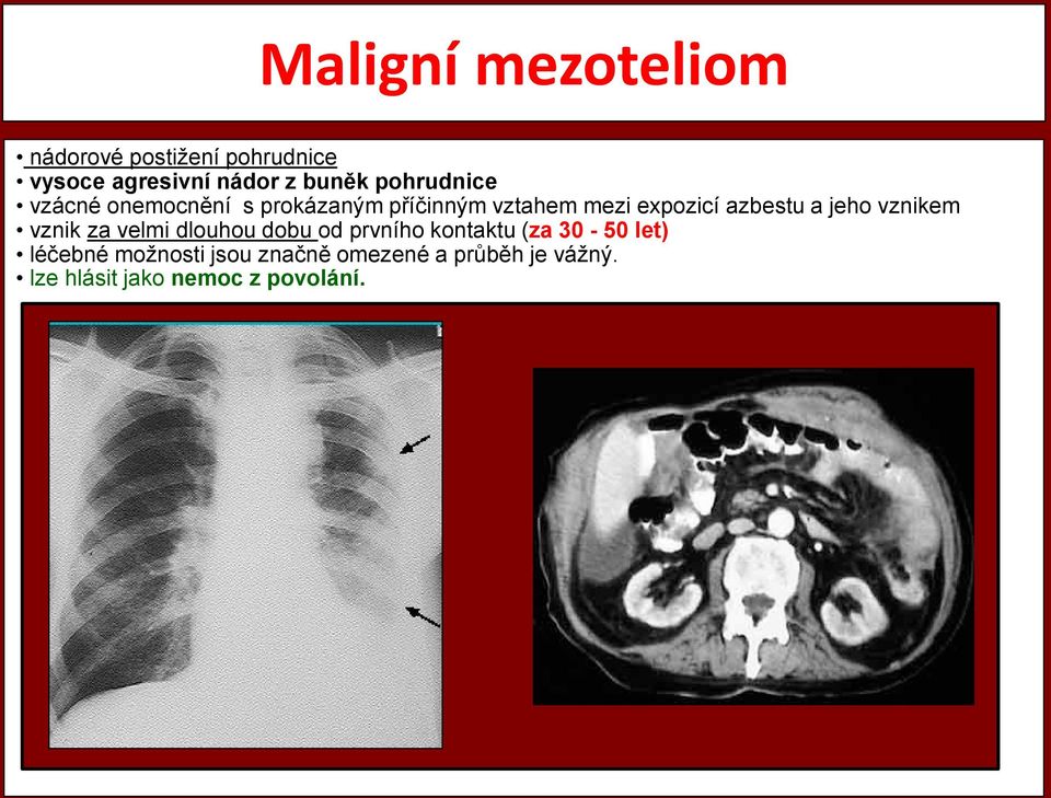 a jeho vznikem vznik za velmi dlouhou dobu od prvního kontaktu (za 30-50 let)