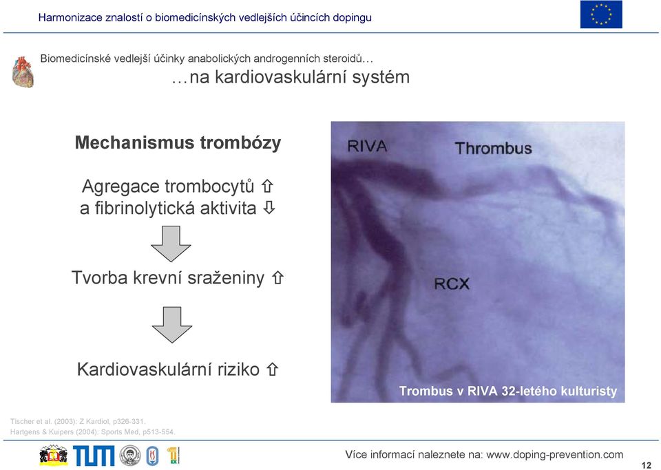 krevní sraženiny Kardiovaskulární riziko Trombus v RIVA 32-letého kulturisty Tischer