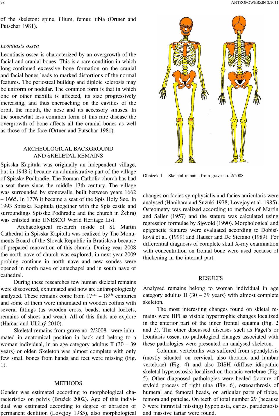 The periosteal buildup and diploic sclerosis may be uniform or nodular.