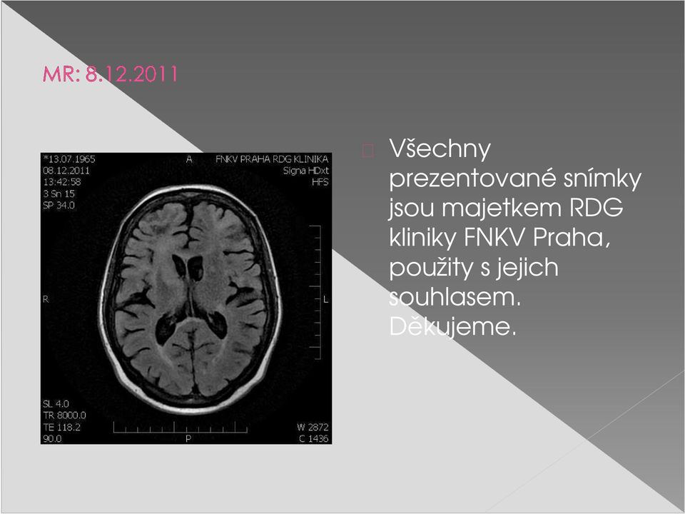 kliniky FNKV Praha,