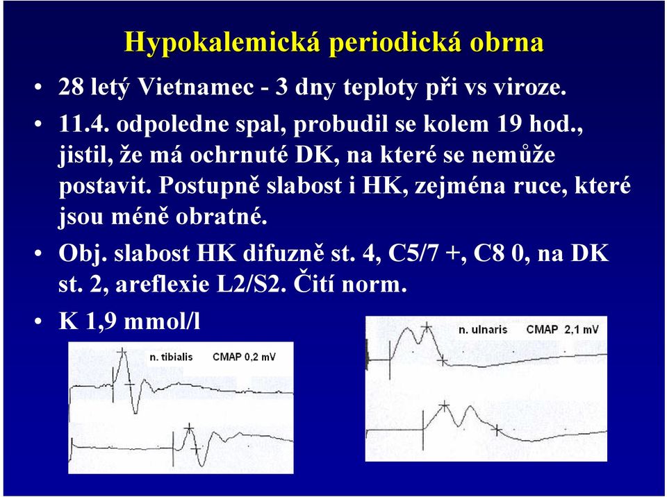 , jistil, že má ochrnuté DK, na které se nemůže postavit.