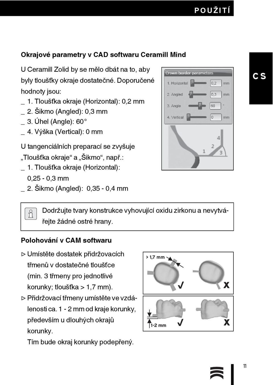 Tloušťka okraje (Horizontal): 0,25-0,3 mm _ 2. Šikmo (Angled): 0,35-0,4 mm Dodržujte tvary konstrukce vyhovující oxidu zirkonu a nevytvářejte žádné ostré hrany.