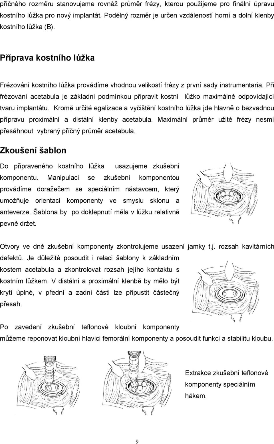 Při frézování acetabula je základní podmínkou připravit kostní lůžko maximálně odpovídající tvaru implantátu.