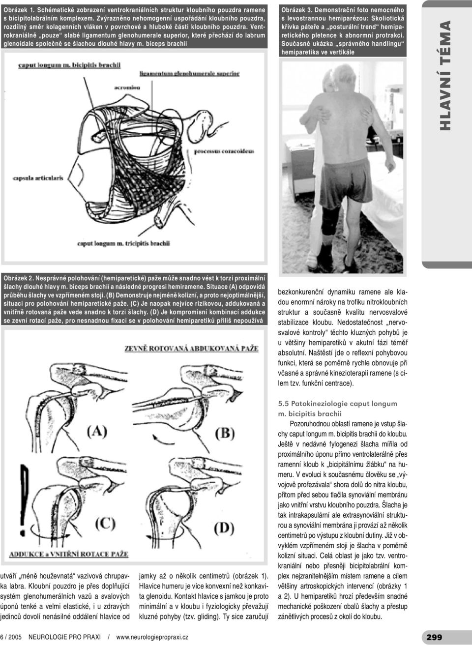 Ventrokraniálně pouze slabé ligamentum glenohumerale superior, které přechází do labrum glenoidale společně se šlachou dlouhé hlavy m. biceps brachii Obrázek 3.