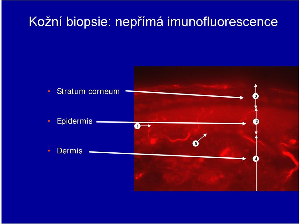 imunofluorescence